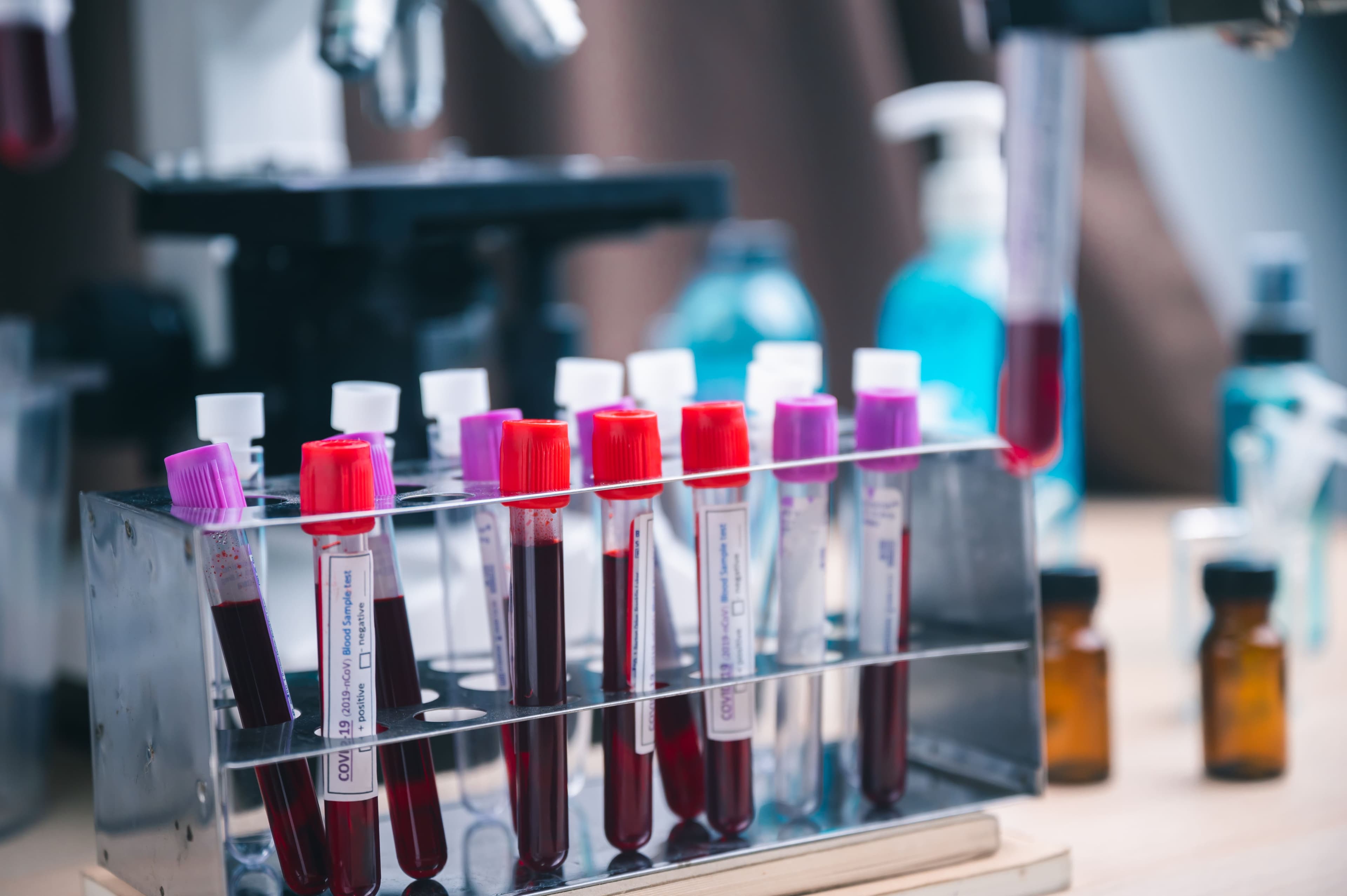 Università E Campus Master Di Primo Livello in Esperto in Accessi Vascolari